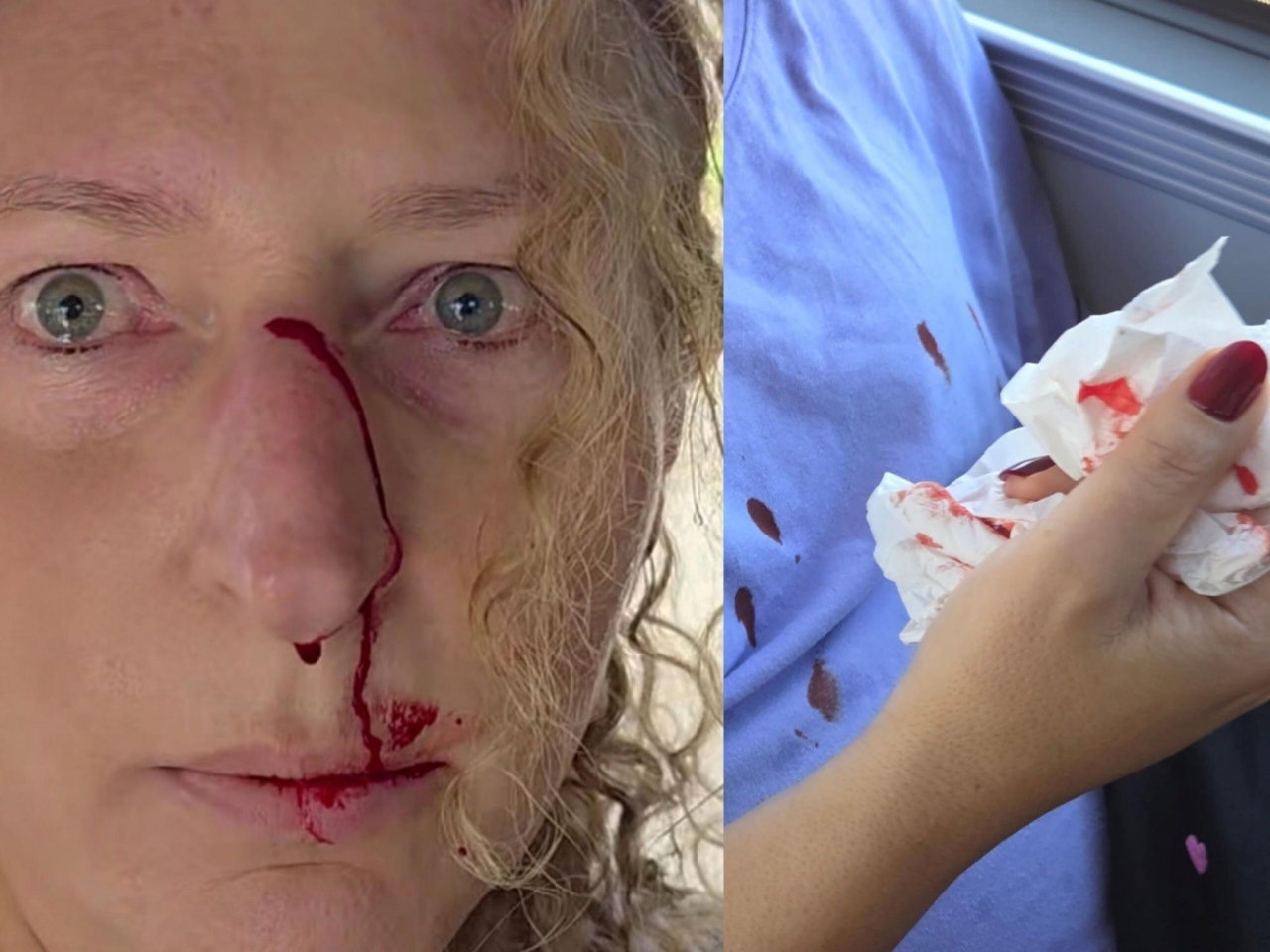 У Польщі чоловік ударив жінку, що захищала українку від образ 2