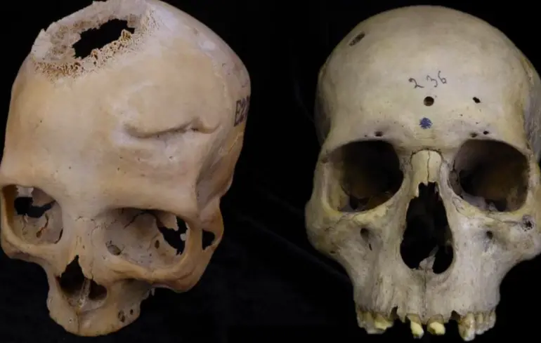 На еволюцію мозку міг вплинути свинець - Homo sapiens краще адаптувався до токсину, ніж неандертальці - новини науки 1