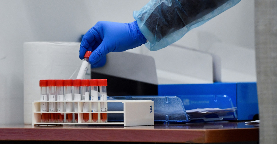 В Україні в останній тиждень серпня через COVID-19 померли 14 людей 1