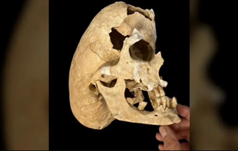 Лицар із генетичним захворюванням - археологи знайшли в Іспанії незвичайний скелет 1