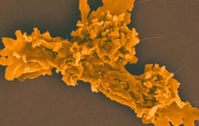 Відкрито амебу, що росте при 63°C - Incendiamoeba cascadensis встановила температурний рекорд серед еукаріотів - новини науки 1