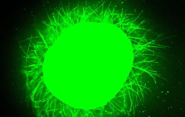 Чи можливо вилікувати спинний мозок - науковці протестували новий підхід на органах, отриманих у лабораторних умовах. Чи можливо вилікувати спинний мозок - науковці протестували новий підхід на органах, отриманих у лабораторних умовах. 1