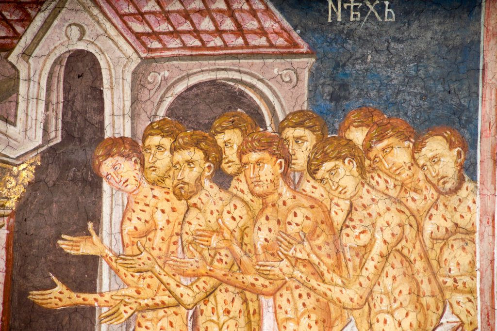 Інкубаційний період до десятків років: чи загрожує Україні проказа 1