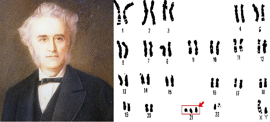 Всесвітній день людей із синдромом Дауна: історія, факти та особливості. 2