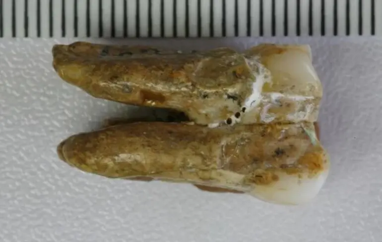 Дослідники виявили ознаки гібридизації між денисівцями та Homo erectus, що має значне значення для розуміння еволюційних процесів. 1